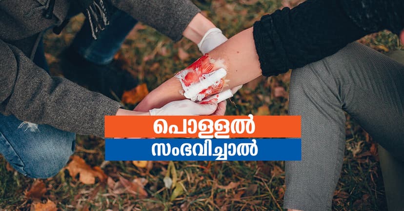 പൊള്ളൽസംഭവിച്ചാൽ